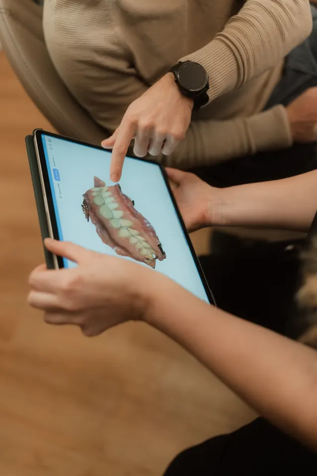 Persönliche Beratung anhand eines digitalen Zahnmodells in unserer Praxis